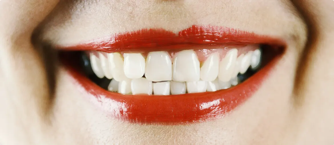 After dental treatment at Orca Dental Clinic, Madurai